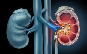 Urology
